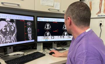 FOTO: V banskobystrickej nemocnici dávajú nádej pacientom s rakovinou pečene. Využívajú revolučnú operáciu