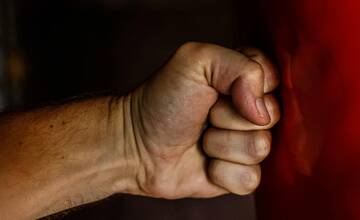 Vybité zuby či útok palicou. Pacienti v Rooseveltovej nemocnici sú agresívnejší, personál spravil rázny krok