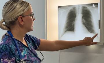VIDEO: V Banskobystrickom kraji je nedostatok pľúcnych lekárov. Župa hľadá riešenia