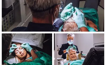 Revolučná transplantácia vlasov: Spoľahnite sa na odborníkov v Inštitúte Dr. Popoviča a získajte späť svoje sebavedomie