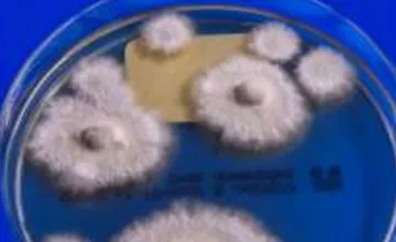 Po Európe sa šíri superpleseň, liečba je náročná. Nakazili sa ňou už aj Slováci, na čo si dať pozor?