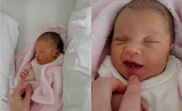 FOTO: Lekári v Banskobystrickom kraji ostali poriadne zaskočení, narodilo sa im bábätko so zubom