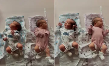 V nemocnici v Brezne sa narodili najväčšie dvojičky za posledných 50 rokov. Koľko vážili pri pôrode?