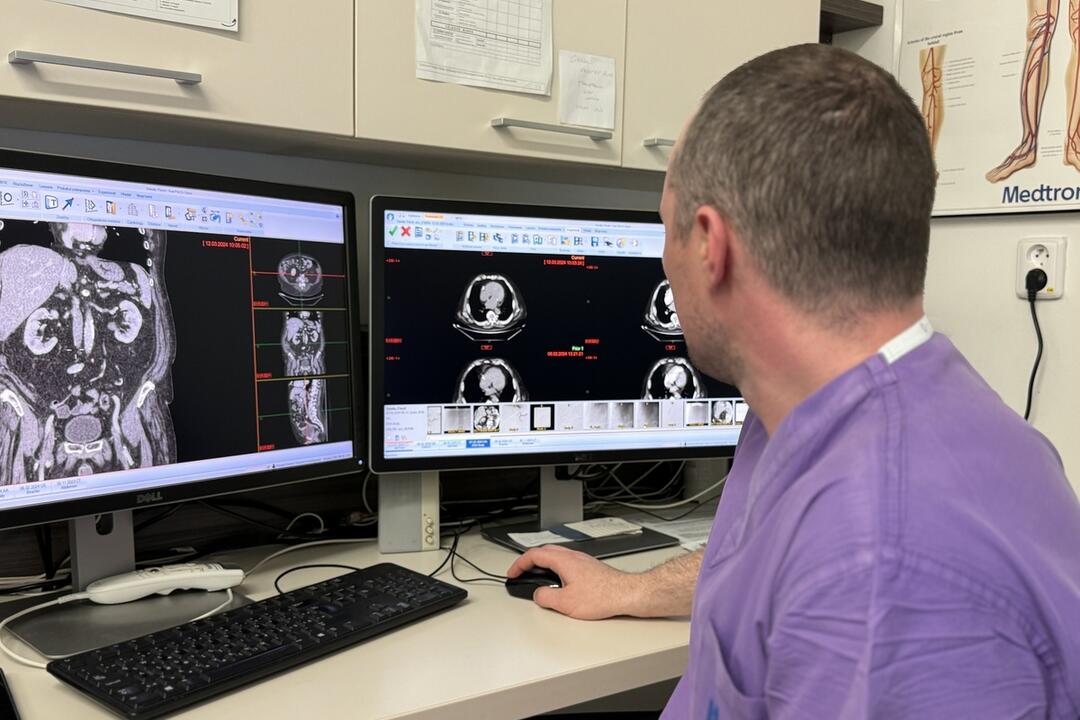 FOTO: Liečba rakoviny pečene prostredníctvom revolučnej miniinvazívnej operácie, foto 5