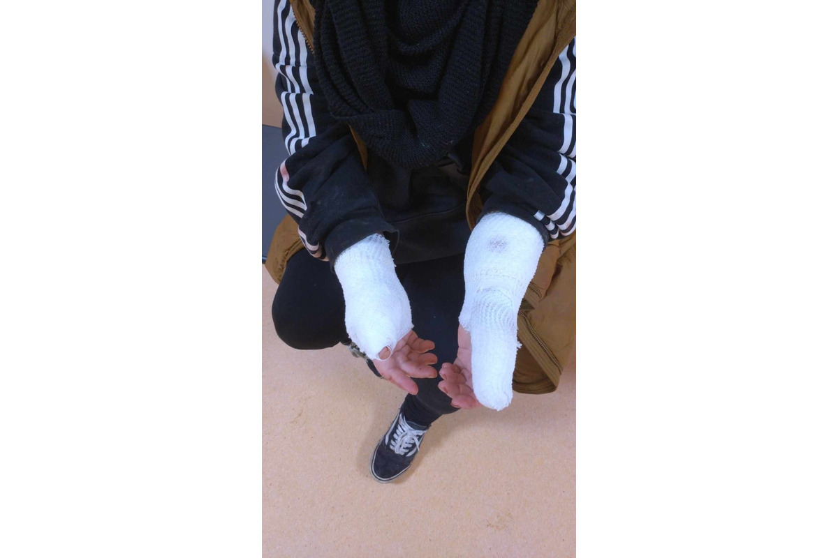 FOTO: Na sídlisku v Banskej Bystrici došlo k nepríjemnej bitke psov. Napadnuté zviera aj majiteľka zostali dohryzení, foto 2