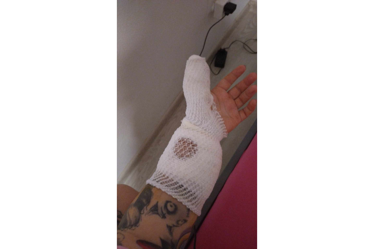 FOTO: Na sídlisku v Banskej Bystrici došlo k nepríjemnej bitke psov. Napadnuté zviera aj majiteľka zostali dohryzení, foto 3