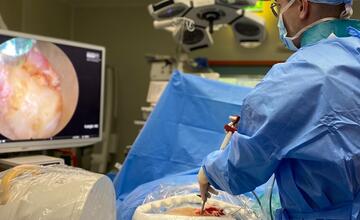 FOTO: Neurochirurgovia z banskobystrickej nemocnice zoperovali pacientku pomocou spinálnej plne endoskopickej 4K zostavy