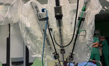 FOTO: Rooseveltova nemocnica spustila robotickú chirurgiu v krčnom lekárstve